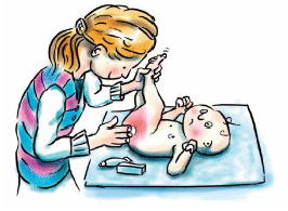 How to prevent diaper rash